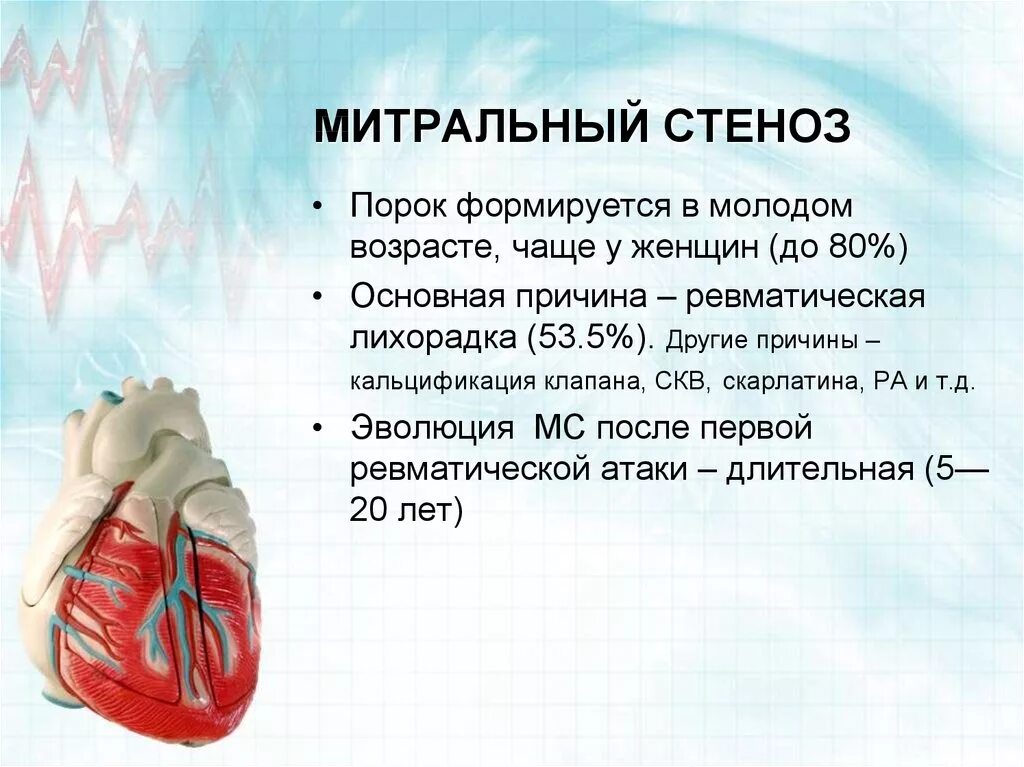 Митральный стеноз сердца. Митральные пороки сердца. Митральные пороки сердца причины. Митральный стеноз признаки