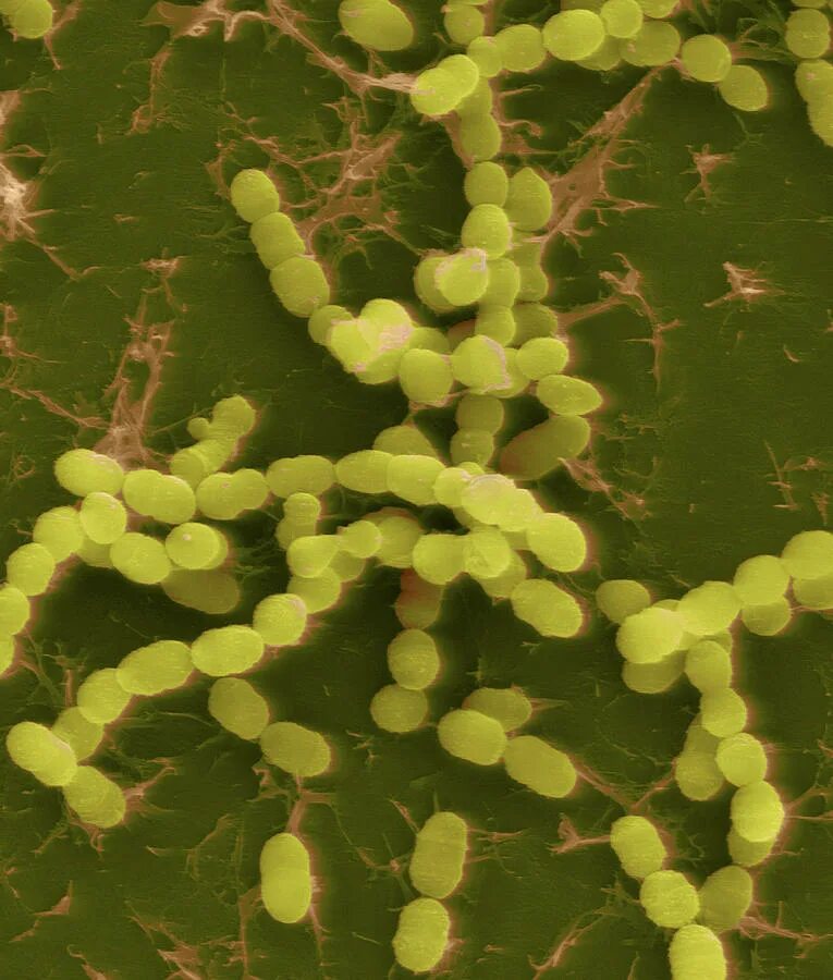 Streptococcus thermophilus