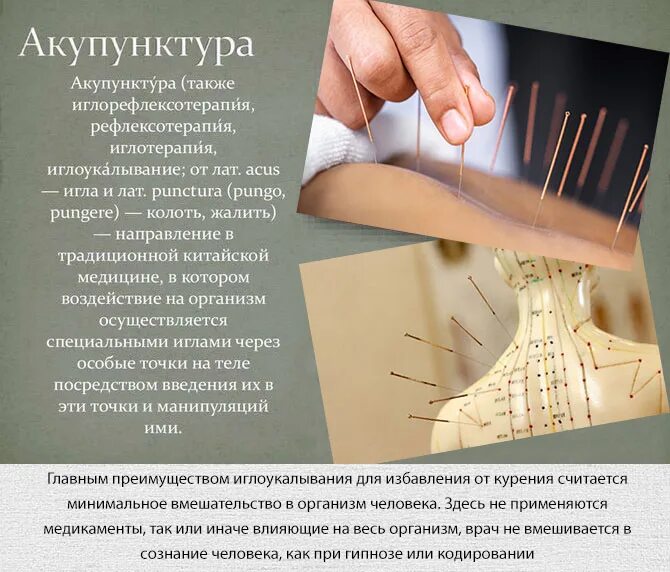 Иглоукалывание фото. Акупунктура отзывы. Рефлексотерапия иглоукалывание акупунктура. Иглоукалывание тибет. Акупунктура отзывы.