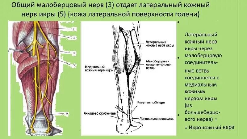 Нейропатия бедра. Малоберцовый нерв дерматом. Вторичная нейропатия малоберцового нерва. Полинейропатия бедренного нерва. Повреждение поверхностного малоберцового нерва.