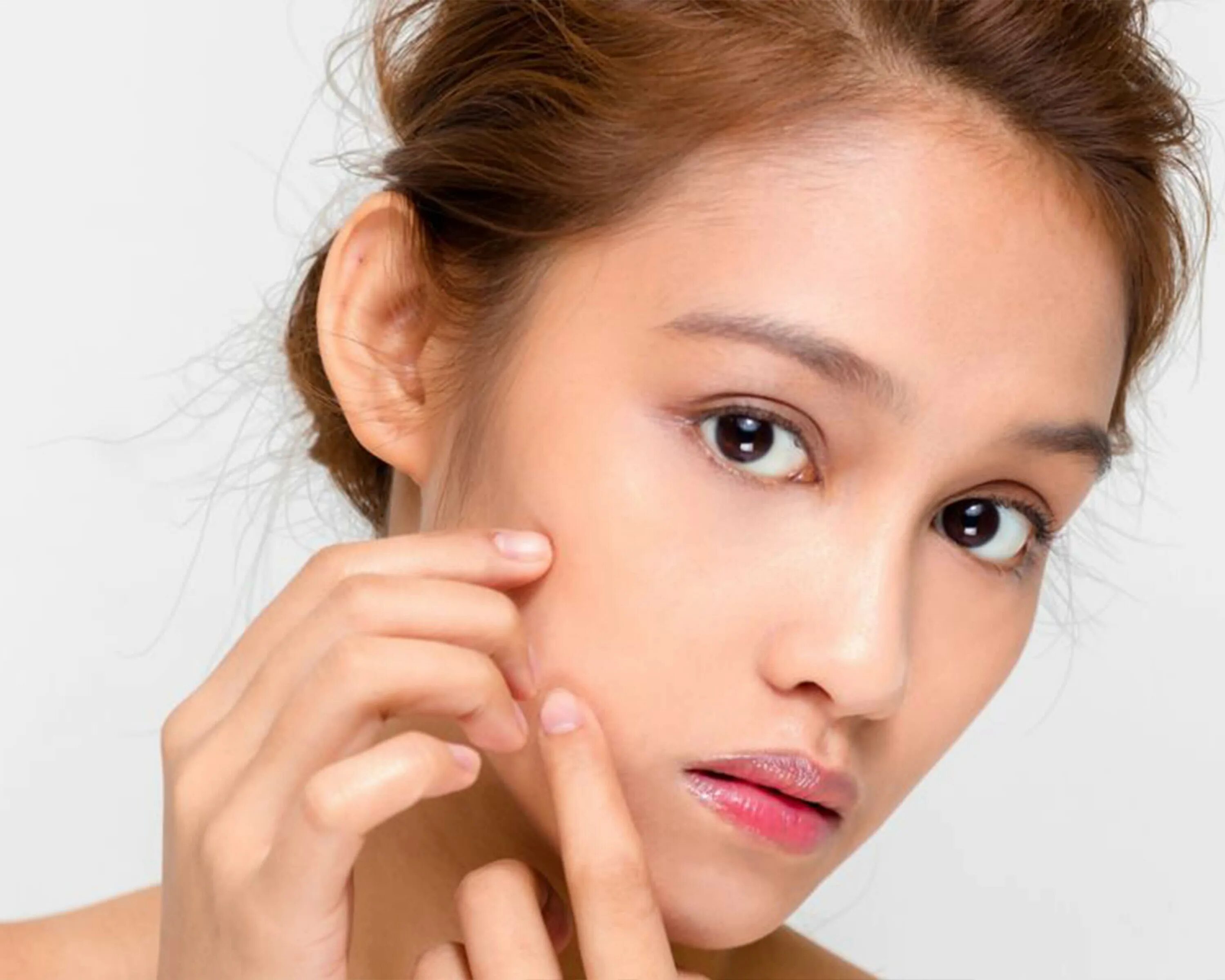 Девушка с проблемной кожей. Девушка с безупречной кожей. Skin care. Девушка с проблемной кожеq. Cares acne skin care.