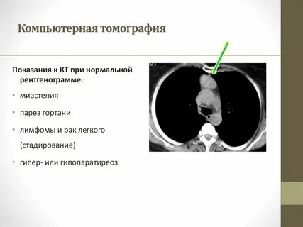 Кт показания
