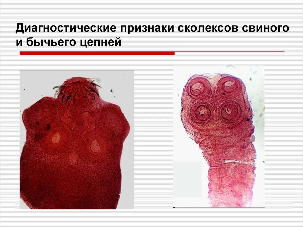 Невооруженный. Сколекс бычьего цепня микроскоп. Сколексв бычьего свиного цепней.