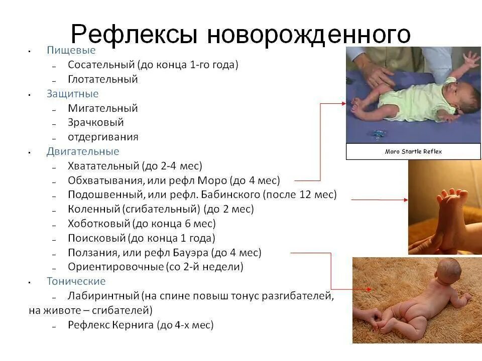 Рефлекс Кернига у новорожденного. Двигательные рефлексы новорожденного. Рефлексы новорожденного Бабинского Моро. Рефлексы новорожденных с 1 месяца у новорожденных.