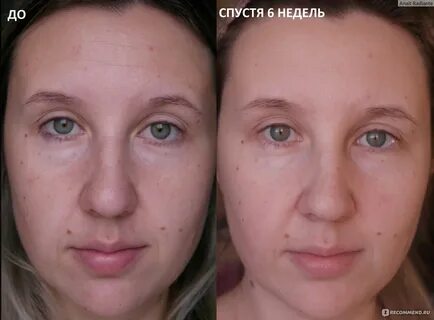 Уменьшение тона