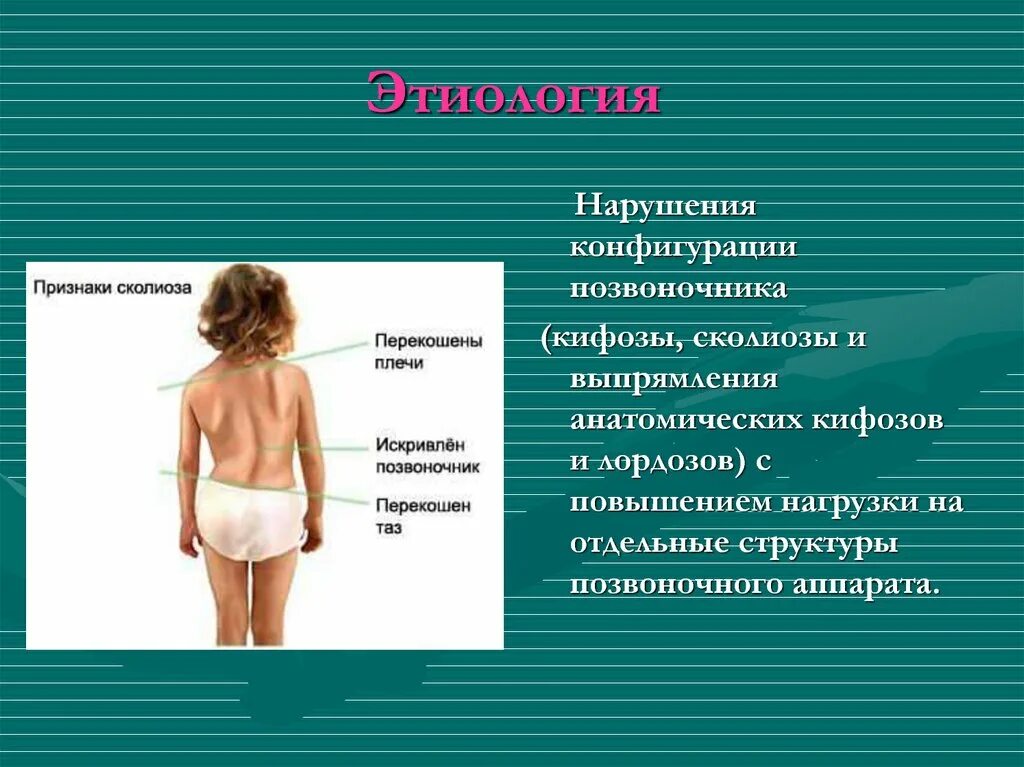 Нарушение конфигурации
