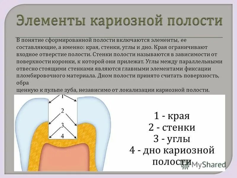 Способы препарирования кариозных полостей. Способы препарирования кариозных полостей. Метод профилактического расширения кариозной полости. Способы и принципы препарирования кариозных полостей. Способы препарирования кариозных полостей.