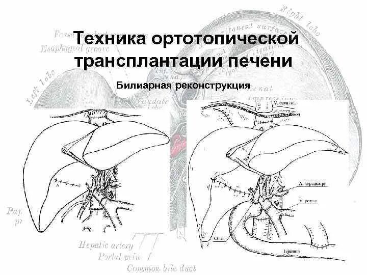 СНК кафедры Госпитальной хирургии 2 лечебного факультета