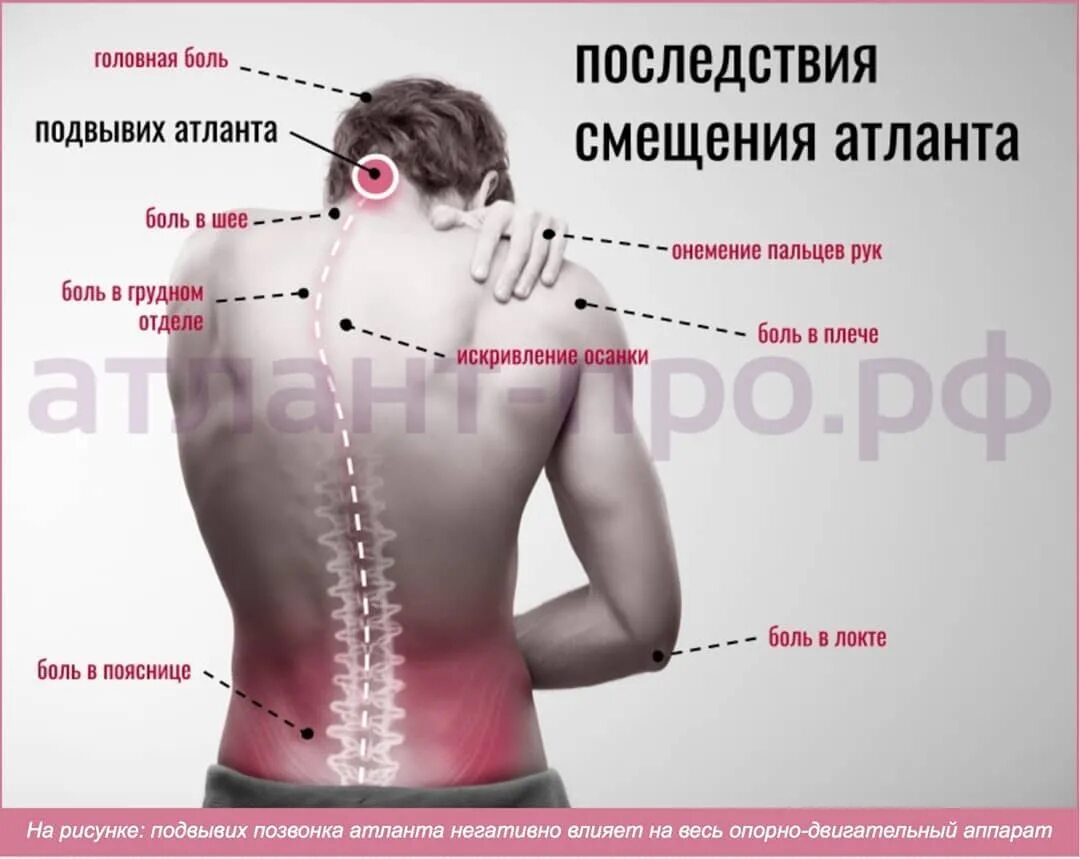 Банки при болях в спине. Смещенный шейный позвонок. Правка шейных позвонков. Смещен первый позвонок. Сдвинут шейный позвонок.