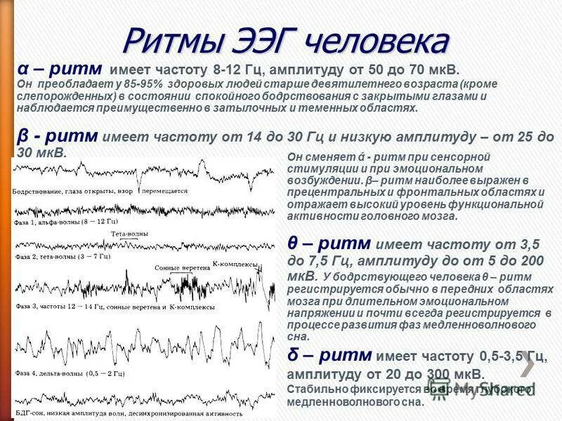 Диффузная активность мозга. Параметры Альфа ритма на ЭЭГ. ЭЭГ головного мозга ритм Альфа ритм норма. Дельта ритм ЭЭГ. Норма Альфа ритма головного мозга при ЭЭГ.