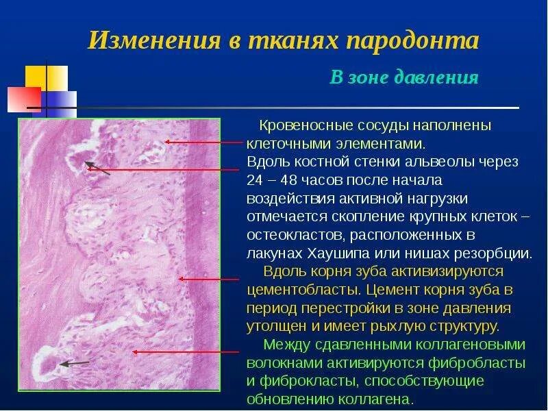 Структурные изменения ткани