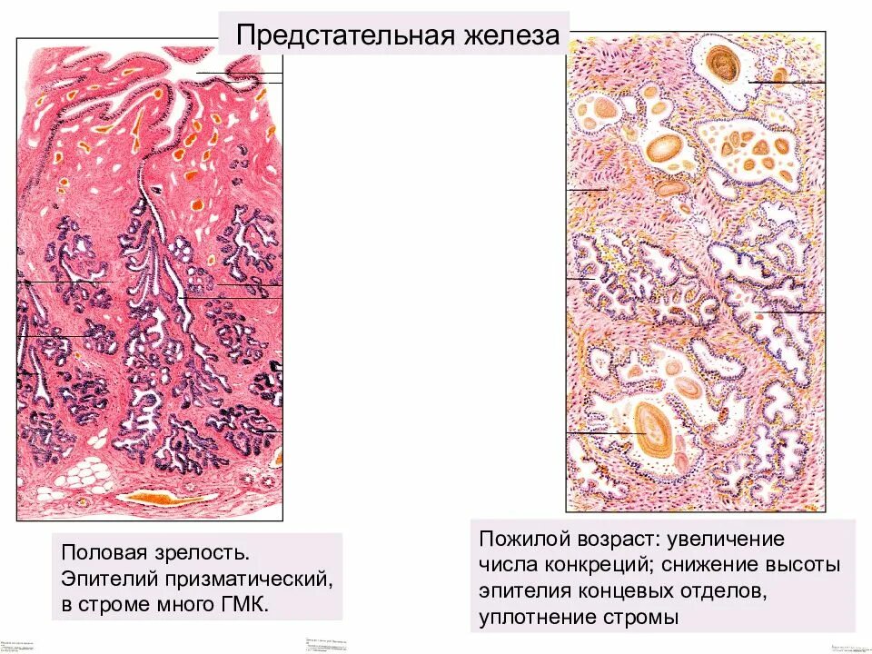 Простата это железа. Схема строения предстательной железы гистология. Срез предстательной железы гистология. Строение предстательной железы гистология. Простата гистология препарат.