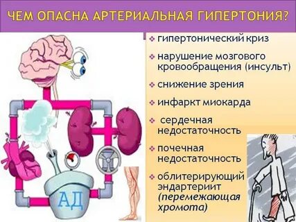 Гипертонический криз инсульт