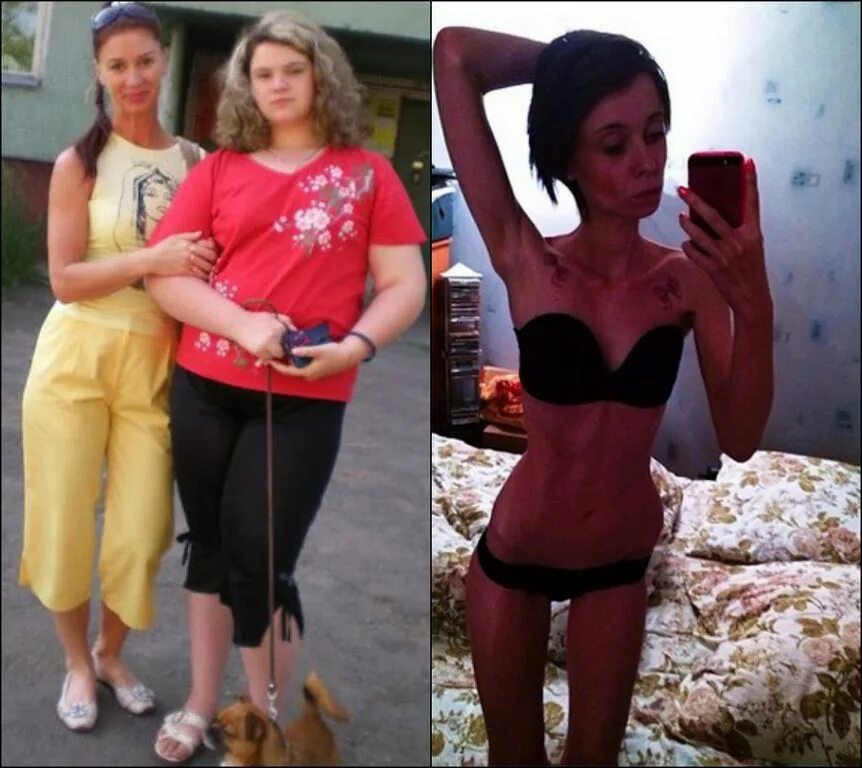 Света солар до похудения и после Pin on weight loss