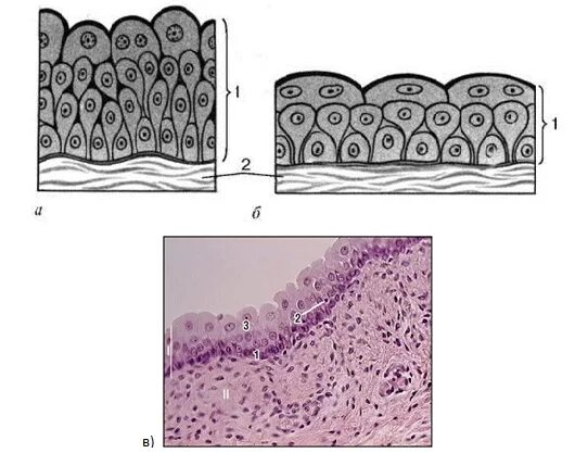 Слои переходного эпителия. Эпителий мочевого пузыря гистология. Многослойный переходный эпителий мочевого пузыря. Многослойный переходный эпителий строение. Переходный эпителий мочевого пузыря гистология.