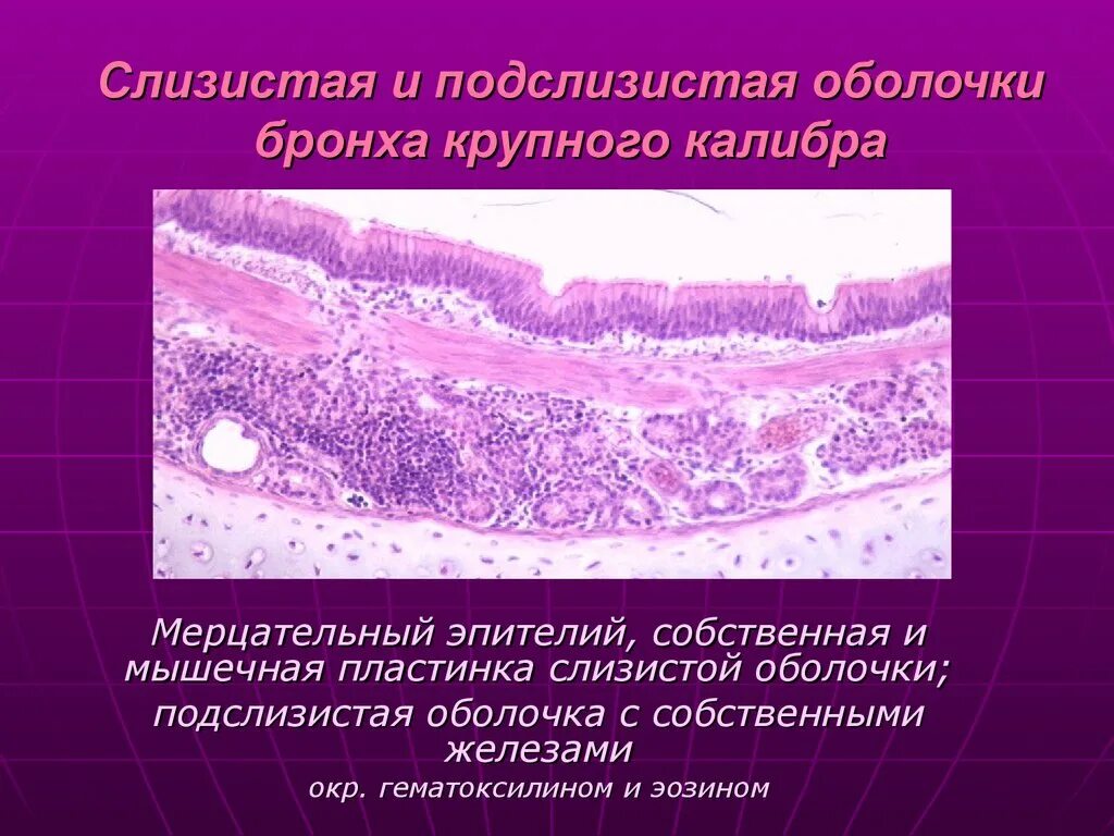 Мерцательный эпителий бронхов гистология. Строение слизистой оболочки бронхов. Мерцательный эпителий слизистой оболочки. Эпителий слизистой оболочки бронхов.