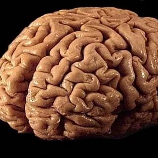 Исследователи мозга человека