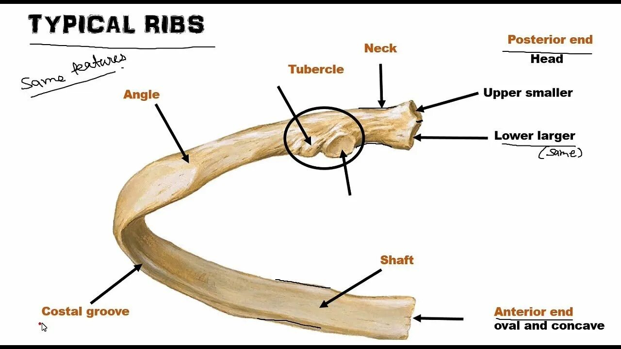 It is typical of. Ребра анатомия. ребро кость. typical rib. 12 ребро анатомия.