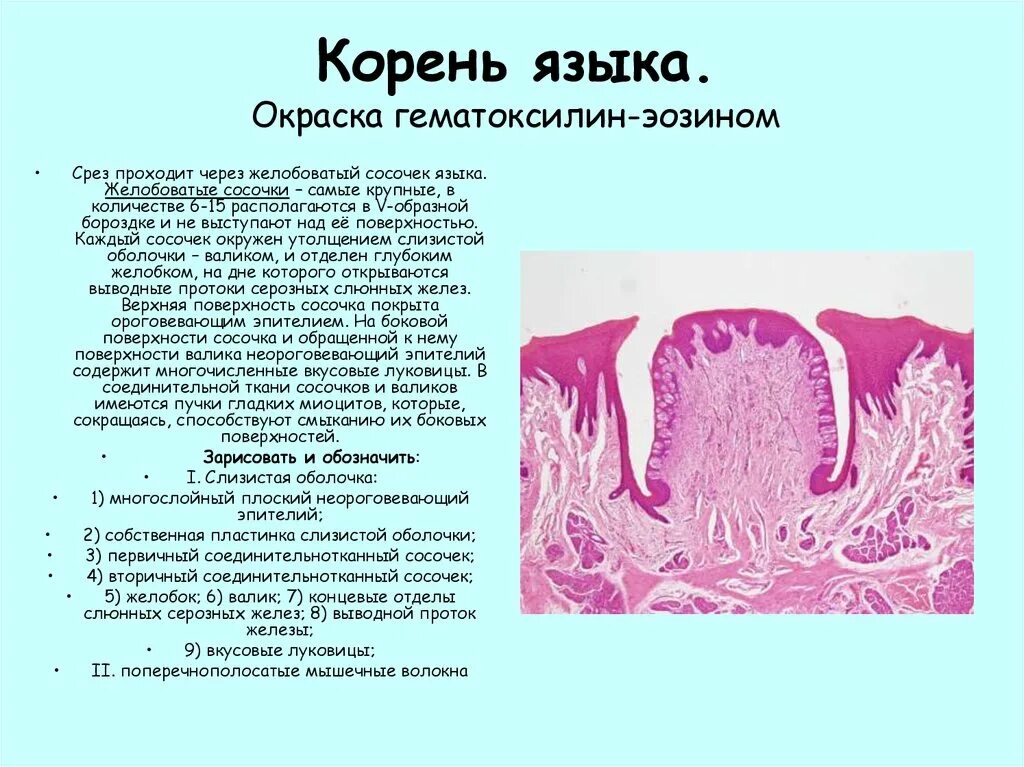 Желобовидные сосочки языка гистология. Желобоватый сосочек языка гистология. Желобоватый сосочек языка гистология препарат. Нитевидный сосочек языка окраска гематоксилином эозином.