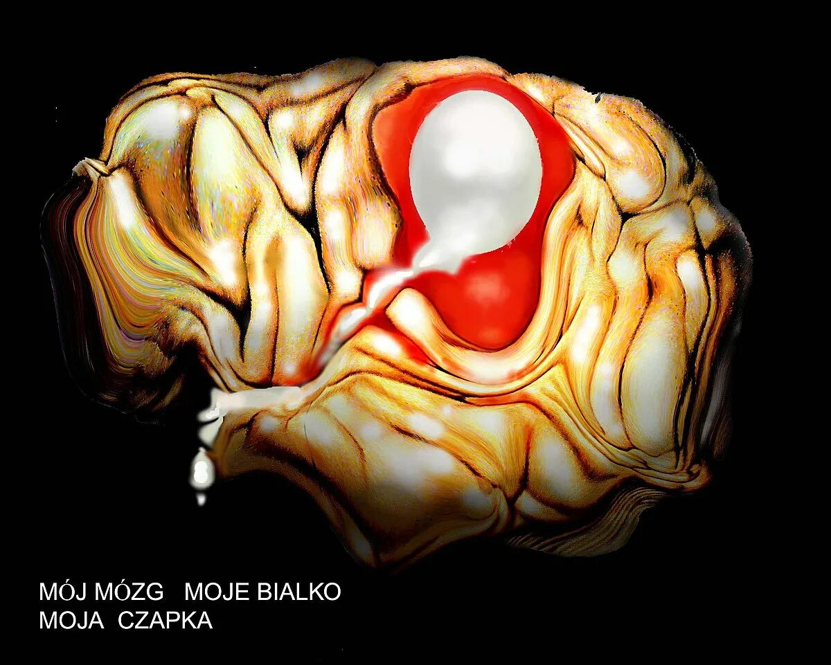 Brain 70. Мозг стекает.