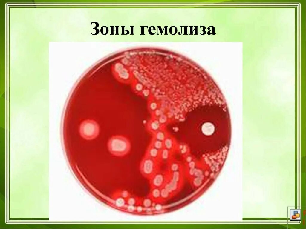 Бета гемолиз на кровяном агаре. Зона гемолиза на кровяном агаре. Зона гемолиза на кровяном агаре. Гемолиз стрептококков на кровяном агаре. Синегнойная палочка гемолиз.