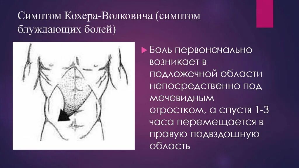 Боли в подложечной области диагноз. Острый аппендицит симптом кохера Волковича. Острого аппендицита - симптомы Волковича. Симптом Волковича-кохера при остром аппендиците. Симптом Воскресенского острый аппендицит.