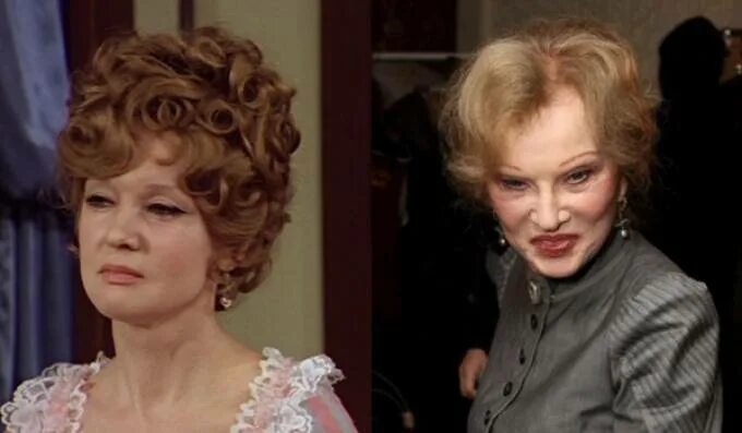 Гурченко послемвсех пластик. Людмила гурченко фото. Людмила гурченко пластика. Людмила гурченко пластические операции. Гурченко пластические операции.