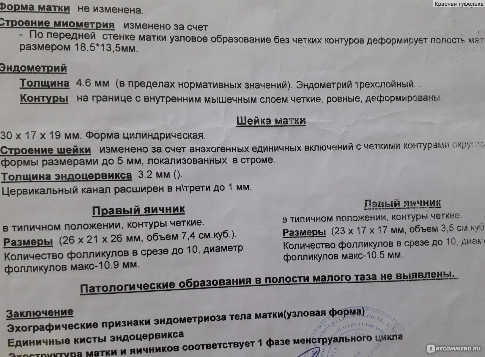 Выскабливание в постменопаузе отзывы. Выделения после выскабливания полости матки норма. Выскабливание полости матки при замершей беременности. Свечи после выскабливания. Раздельное диагностическое выскабливание полости матки.