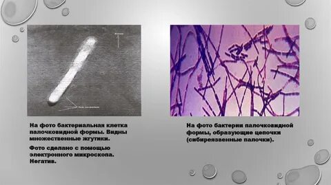Вижу бактерии
