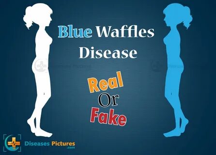 Голубые вафли blue waffles 67 красивых фото.