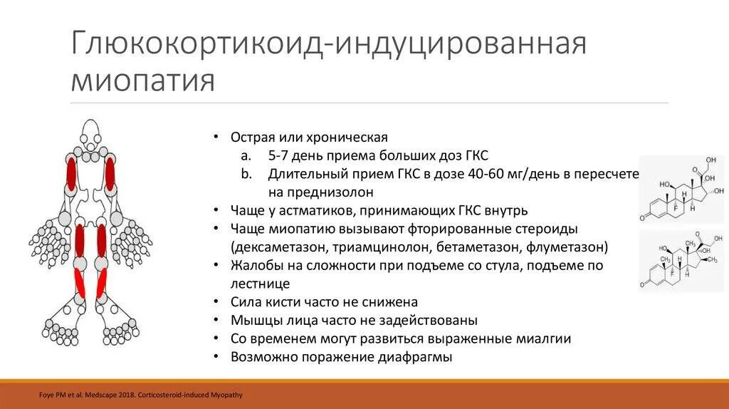 Миопатия симптомы и лечение у женщин. Нервно-мышечные заболевание миопатия. глюкокортикоидная миопатия. мышечная дистрофия миопатия. дистальная форма миопатии.