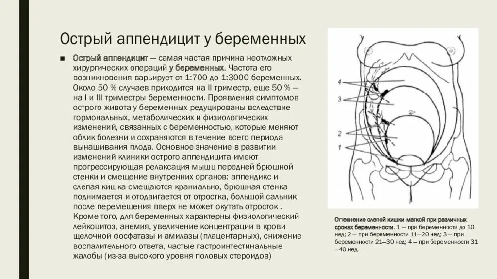 Половой акт после операции. Аппендицит и беременность клинические рекомендации. Доступ при аппендэктомии у беременных. Беременность при аппендиците специфические симптомы. Симптомы аппендицита у беременных.