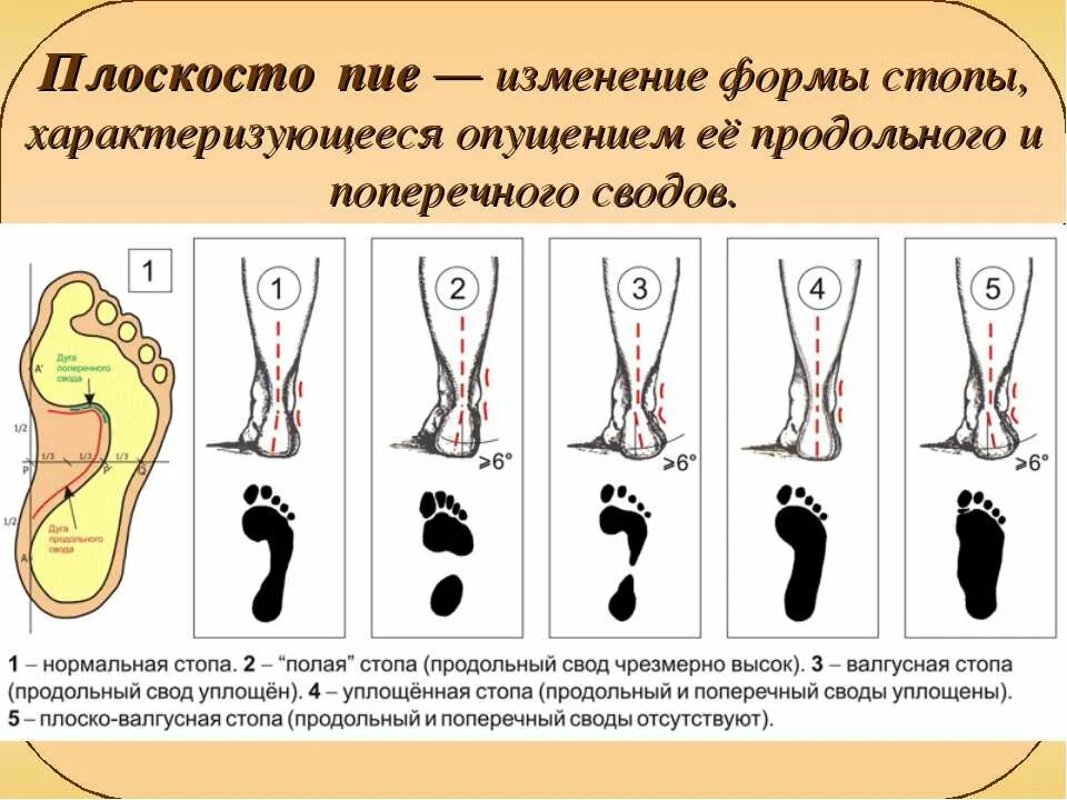 Нарушения стопы. Нарушения стопы