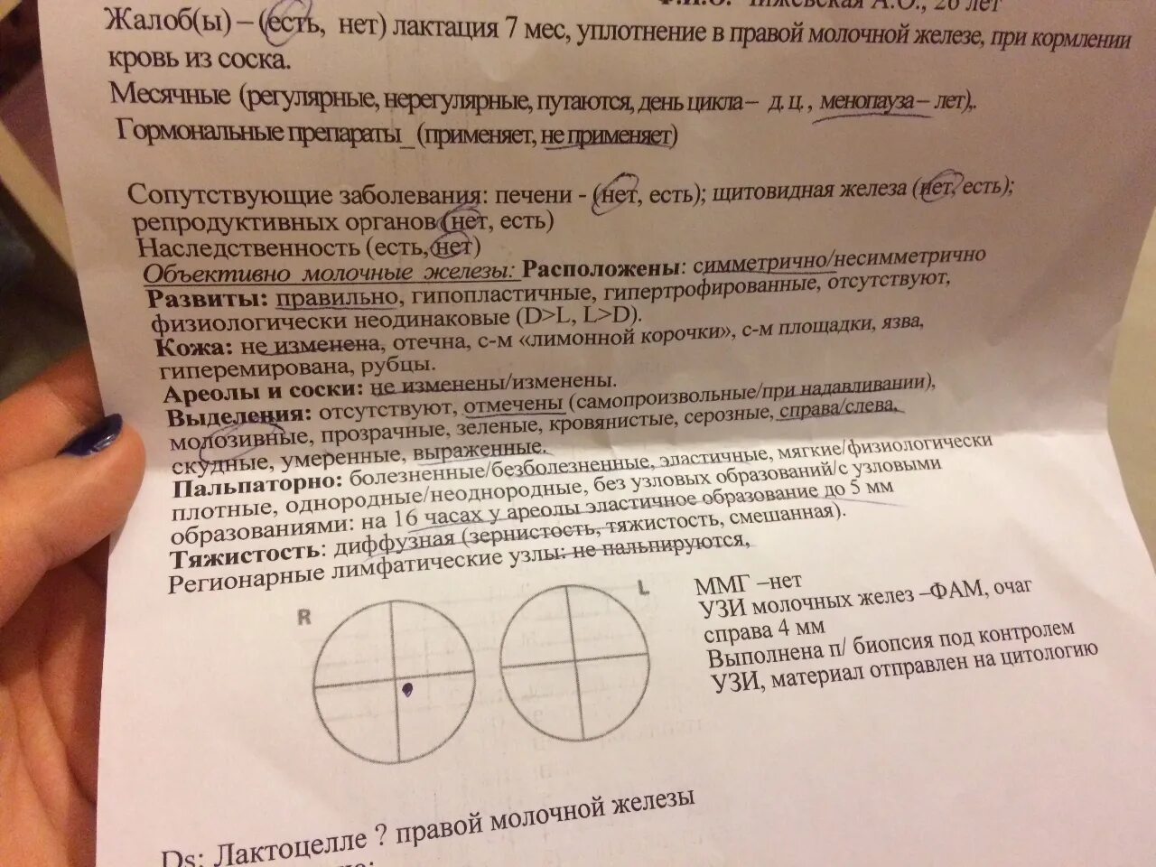 Шишка в грудной железе у женщин. Шишки в грудной железе перед месячными. Болит грудь есть уплотнение. Уплотнение в молочной железе. Уплотнение в молочной железе в виде шарика.