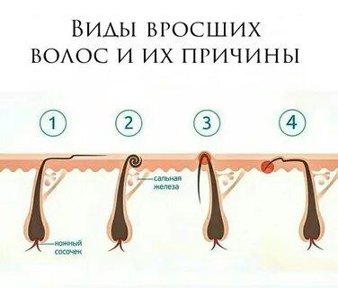 Сколько не растут волосы после воска