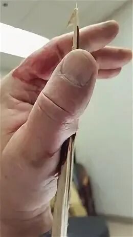 Заноза регистрация