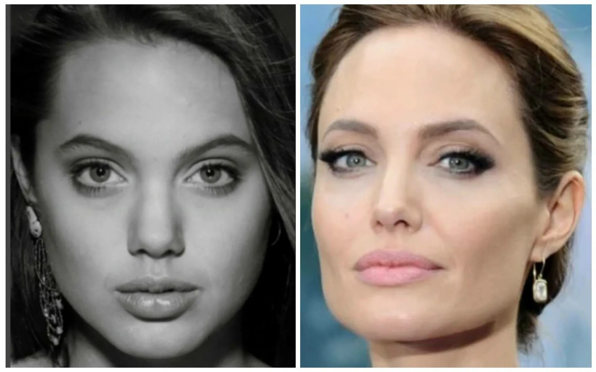 Анджелина джоли до пластики. Анджелина Джоли ринопластика. Губы Анджелины Джоли до и после. Скулы Анджелины Джоли.