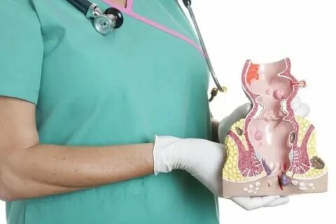 Геморрой боли после дефекации