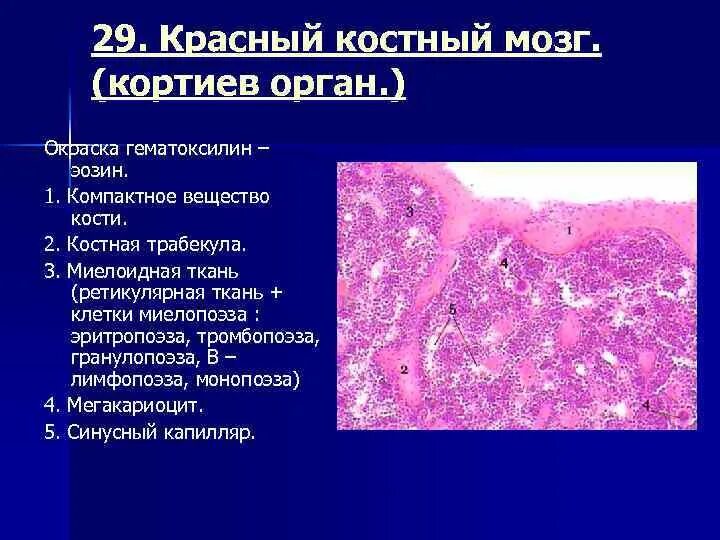 Красный костный мозг окраска гематоксилин эозин. Красный костный мозг гистология гематоксилин эозин. Мазок красного костного мозга окраска гематоксилин-эозин. Красный костный мозг Азур эозин.