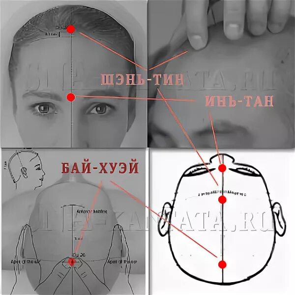 Точки от бессонницы. Точка Шэнь Тин. Точка бай Хуэй. Хуэй Шэнь.