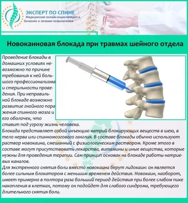 Блокада противопоказания. Блокада шейного отдела позвоночника при остеохондрозе. Новокаиновая блокада при переломе позвоночника. Блокада при остеохондрозе шейного отдела. Препараты для блокады поясничного отдела позвоночника.