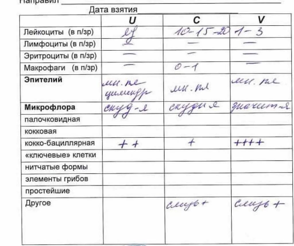 Исследование влагалищных мазков норма. Исследование гинекологического мазка норма. Показатели нормы анализа на флору у женщин. Результаты анализов мазка расшифровка у женщин норма в таблице. Сдать анализы на молочницу