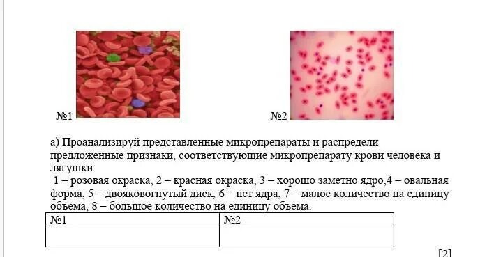 Лабораторная работа сравнение крови лягушки и человека. Микропрепарат кровь человека и кровь лягушки. Микропрепарат крови лягушки и человека. Микропрепараты крови человека и лягушки. Микропрепарат крови лягушки строение.