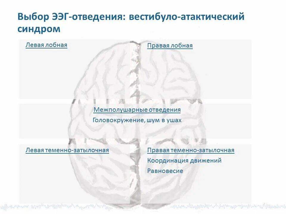 Вестибуло атаксический синдром. Вестибулярно-атактический синдром. Вестилостатический синдром. Вестебулоатактический синдром. Умеренный вестибуло-атаксический синдром.