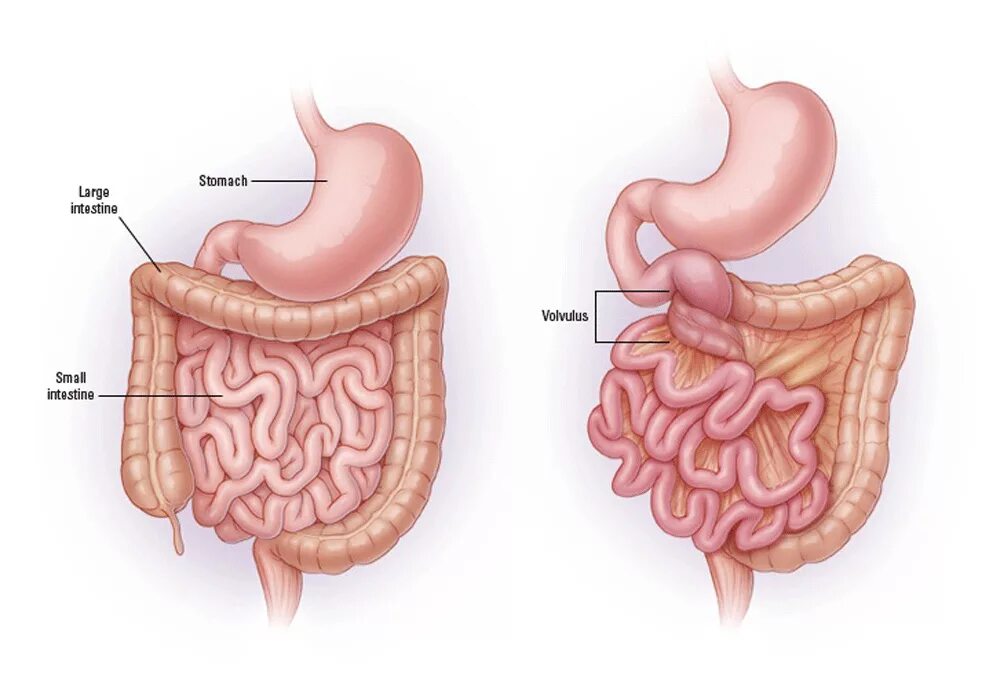 The small intestine. The small intestine