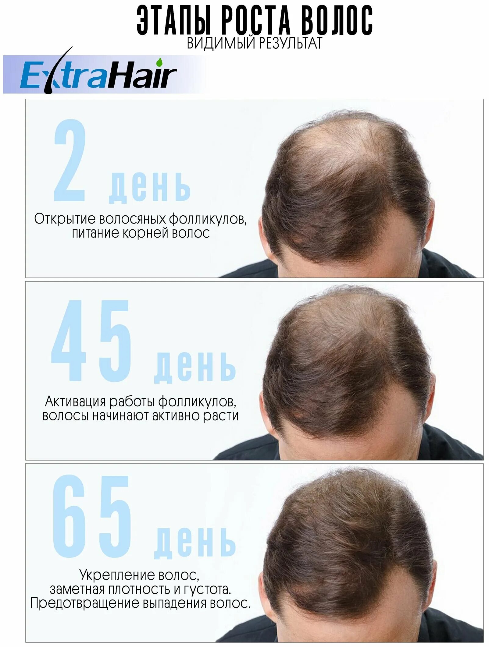 Сильные волосы отзывы. Extra hair для волос. Extra hair результат. Extra hair отзывы.