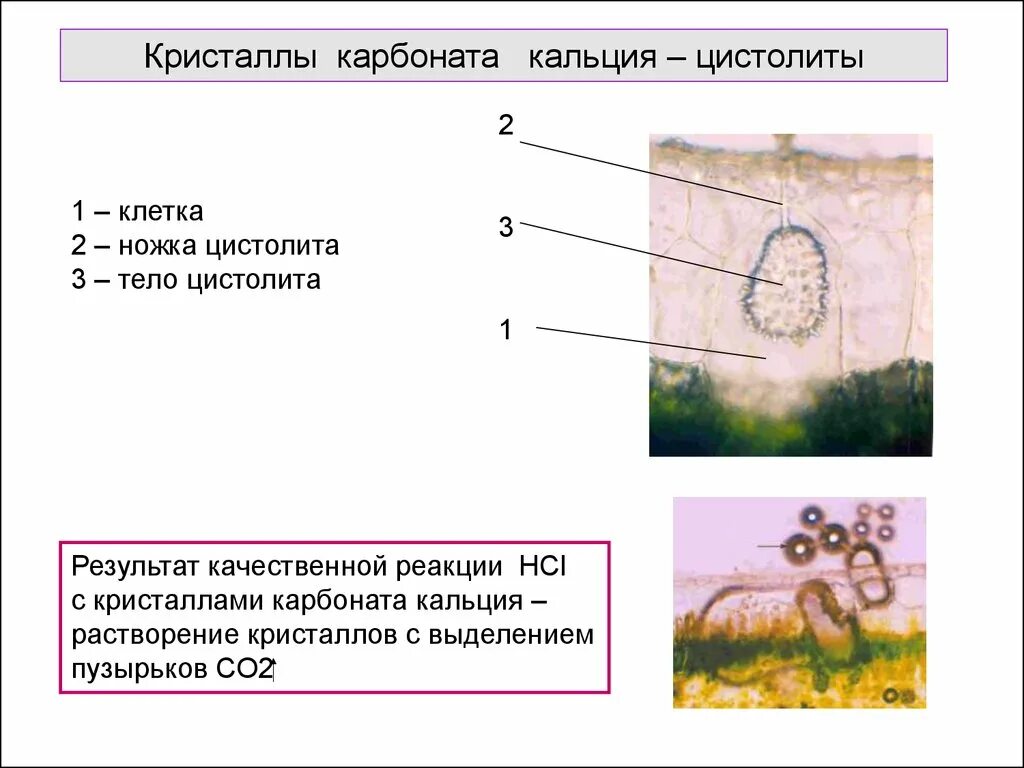 Кристаллы в клетках растений. Цистолиты карбоната кальция. цистолиты в клетках. цистолиты функция. ножка цистолиты.