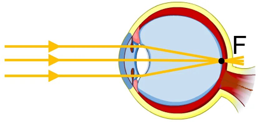 Фокусировка лучей света на внутренней поверхности глазного. Оптическая схема глаза близорукость. Глаз свет падает на сетчатку. Изображение предмета на сетчатке. Формирование изображения на сетчатке глаза.