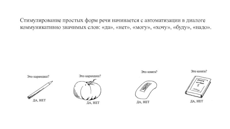 Временная кардиостимуляция. Предсердная стимуляция на экг. Ритм навязан экс. Ритм экс предсердная стимуляция. Двухкамерная стимуляция фото.