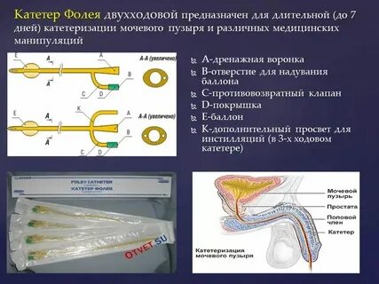 Катетер фолея алгоритм мужчине